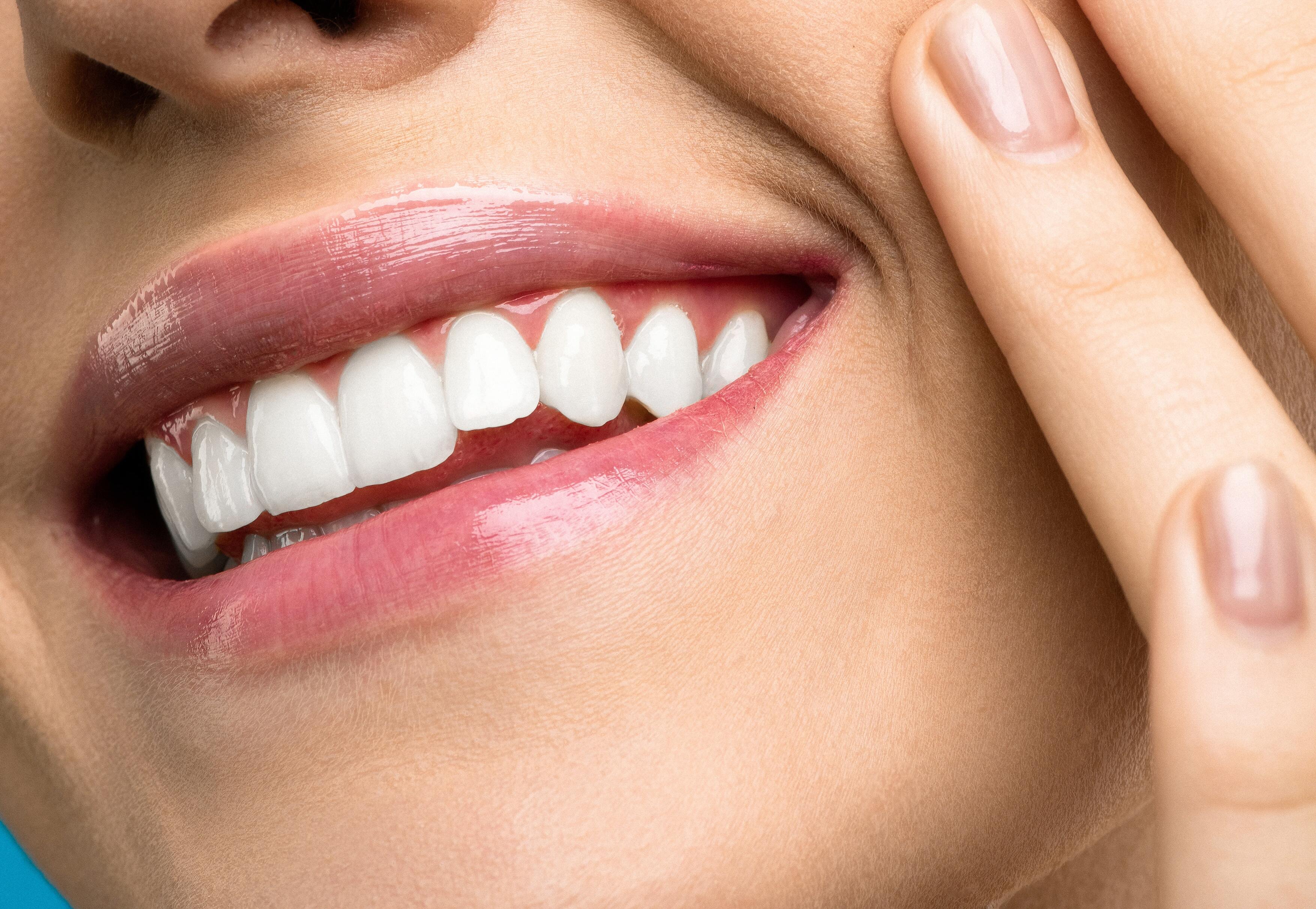 Отбеливание зубов при наличии на передних зубах верхней челюсти фотополимерных пломб